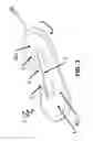 Fig. 02 - Electrical stimulation device