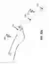 Fig. 22 - Electrical stimulation device