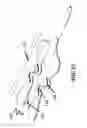 Fig. 28 - Electrical stimulation device