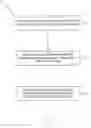 Fig. 02 - Neuromodulatory method for treating chronic or refractory rhinitis