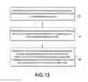 Fig. 08 - Spinal cord stimulation with interferential current