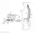 Fig. 01 - Neurostimulation system with flexible patterning and waveforms