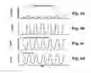 Fig. 05 - Method and apparatus for treatment of cutaneous and subcutaneous conditions