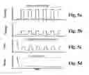 Fig. 04 - Method and apparatus for treatment of cutaneous and subcutaneous conditions