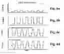 Fig. 05 - Method and apparatus for treatment of cutaneous and subcutaneous conditions