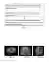 Fig. 05 - GUIDE FOR RADIOACTIVE PARTICLE IMPLANTATION IN ONCOTHERAPY AND METHOD THEREOF