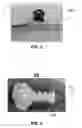 Fig. 03 - System and method for training tongue as a treatment for obstructive sleep apnea