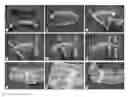 Fig. 01 - Physical therapy device for lower limbs and therapeutic methods thereof