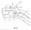 Fig. 08 - Physical therapy device for lower limbs and therapeutic methods thereof