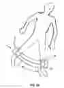 Fig. 10 - Physical therapy device for lower limbs and therapeutic methods thereof