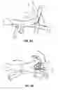 Fig. 12 - Physical therapy device for lower limbs and therapeutic methods thereof