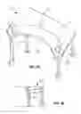 Fig. 13 - Physical therapy device for lower limbs and therapeutic methods thereof