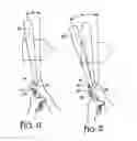 Fig. 06 - Batting pad for adjusting location of bat in batter's hand