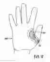 Fig. 10 - Batting pad for adjusting location of bat in batter's hand