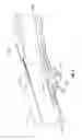 Fig. 06 - Refillable air filter assembly