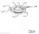 Fig. 11 - Capped carbon filter assembly