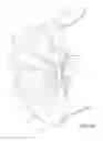 Fig. 17 - Partial wheel cladding