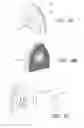 Fig. 09 - Case and mount system for handheld electronic device