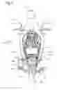 Fig. 04 - Motorcycle
