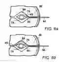 Fig. 07 - String trimmer head with curved trimmer line guide