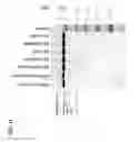 Fig. 12 - METHODS OF PURIFYING ANTIBODIES