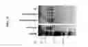 Fig. 13 - METHODS OF PURIFYING ANTIBODIES