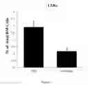 Fig. 04 - NOVEL PEPTIDES FOR PREVENTING OR TREATING BONE DISEASES AND USE THEREOF