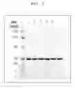 Fig. 02 - Factor H binding protein variants and methods of use thereof