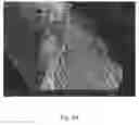 Fig. 07 - Black ceramic additives, pigments, and formulations