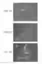 Fig. 02 - METHODS USING REPROGRAMMED CELLS FOR REGENERATIVE, RESTORATIVE, AND REJUVENATIVE THERAPIES