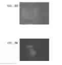 Fig. 14 - METHODS USING REPROGRAMMED CELLS FOR REGENERATIVE, RESTORATIVE, AND REJUVENATIVE THERAPIES