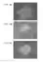 Fig. 22 - METHODS USING REPROGRAMMED CELLS FOR REGENERATIVE, RESTORATIVE, AND REJUVENATIVE THERAPIES