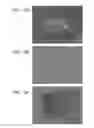 Fig. 23 - METHODS USING REPROGRAMMED CELLS FOR REGENERATIVE, RESTORATIVE, AND REJUVENATIVE THERAPIES
