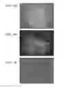 Fig. 24 - METHODS USING REPROGRAMMED CELLS FOR REGENERATIVE, RESTORATIVE, AND REJUVENATIVE THERAPIES