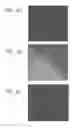 Fig. 29 - METHODS USING REPROGRAMMED CELLS FOR REGENERATIVE, RESTORATIVE, AND REJUVENATIVE THERAPIES