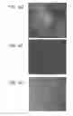 Fig. 30 - METHODS USING REPROGRAMMED CELLS FOR REGENERATIVE, RESTORATIVE, AND REJUVENATIVE THERAPIES