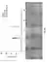 Fig. 05 - DRUG COCKTAIL ANALYSES USING MICROSCALE VORTEX ASSISTED ELECTROPORATION