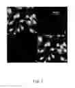 Fig. 06 - Aptamer targeting MAGE-A3 peptide and uses thereof