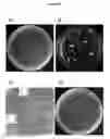 Fig. 03 - MAIZE PLASTID TRANSFORMATION METHOD