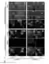 Fig. 25 - Exosomal loading using hydrophobically modified oligonucleotides
