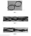 Fig. 03 - Fiber ring reinforcement structures