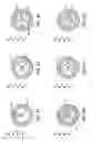 Fig. 25 - Actuatable Plungers with Actuatable External Seals, and Systems and Methods Including the Same