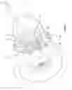 Fig. 08 - Turbine assembly