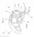 Fig. 06 - Tensioner lever