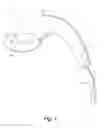 Fig. 02 - STEAMER HEAD