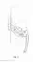 Fig. 04 - STEAMER HEAD