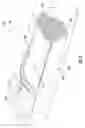 Fig. 03 - Fuel nozzle assembly having a premix fuel stabilizer