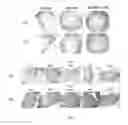 Fig. 04 - COMPOSITIONS, METHODS, AND SYSTEMS FOR TISSUE FIXATION