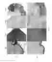 Fig. 08 - COMPOSITIONS, METHODS, AND SYSTEMS FOR TISSUE FIXATION