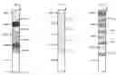 Fig. 01 - REAGENT TEST STRIPS COMPRISING REFERENCE REGIONS FOR MEASUREMENT WITH COLORIMETRIC TEST PLATFORM